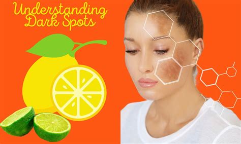 wellhealthorganic.com/easily-remove-dark-spots-lemon-juice|Wellhealthorganic.com/Easily